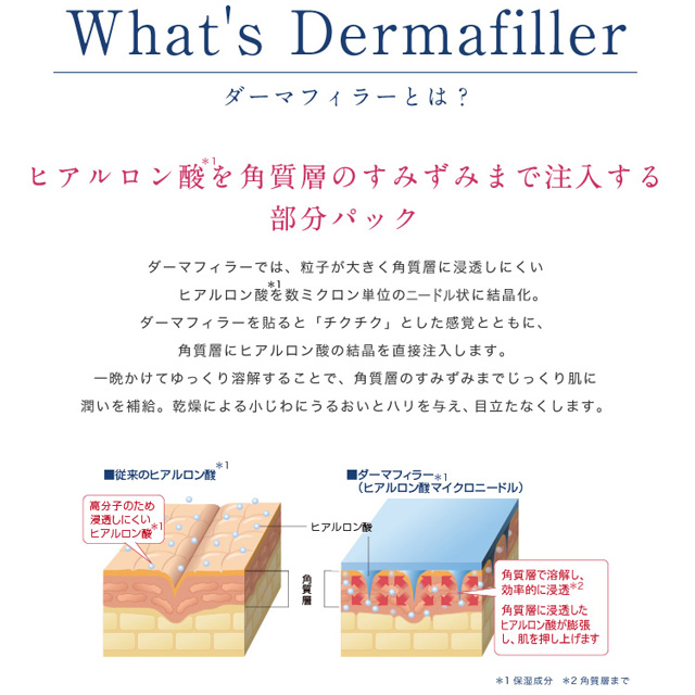 ダーマフィラー（Dermafiller）とは