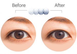 アキュビュー オアシス トランジションズ （ACUVUE OASYS with Transitions）目の変化